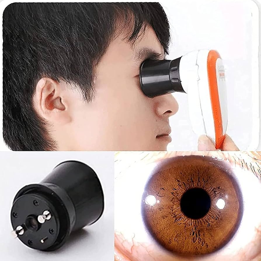 眼をみてわかる健康診断: 健康上のリスクを突きとめる実践的な虹彩学 書籍『眼をみてわかる健康診断』 | ガイアブックス（Gaiabooks）